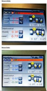 lignage laser avantage